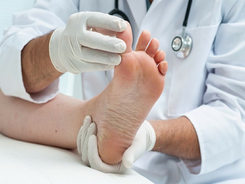 DR. LUIS FARINGTHON ALERTA SOBRE LOS RIESGOS DEL PIE DIABÉTICO Y LLAMA A LA PREVENCIÓN
